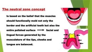 Is based on the belief that the muscles
should functionally mold not only the
border and the artificial teeth but also the
entire polished surface facial and
lingual forces generated by the
musculature of the lips, cheeks and
tongue are balanced.
The neutral zone concept
 