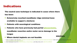 Indications
The neutral zone technique is indicated in cases where there
has been:
 Extensively resorbed mandibular ridge (minimal bone
available to support a denture)
 Patients with neurological conditions
 Patients who have previously had partial glossectomie,
mandibular resection and/or motor nerve damage to the
tongue
 Where dental implants are not feasible.
WIKIPEDIA
1. Gupta, KL; Agarwal, S (Nov–Dec 2011). "Salvation of a severely resorbed mandibular ridge with a neutral zone technique". Indian Journal of Dental Research. 22 (6): 883. doi:
10.4103/0970-9290.94699. PMID 22484902.
2. Marc Geissberger (8 July 2013). Esthetic Dentistry in Clinical Practice. John Wiley & Sons, 2013. ISBN 9781118694930
 