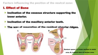 Factors influencing the position of the neutral zone:
I. Effect of Bone
 Inclination of the osseous structure supporting the
lower anterior.
 Inclination of the maxillary anterior teeth.
 The way of resorption of the residual alveolar ridges.
Denture space. A, Cross section in molar
area. B, Lateral view of incisor area.
 