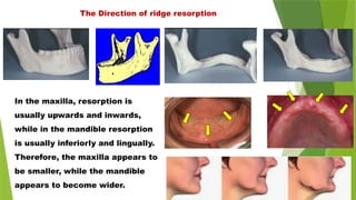 The Direction of ridge resorption
In the maxilla, resorption is
usually upwards and inwards,
while in the mandible resorption
is usually inferiorly and lingually.
Therefore, the maxilla appears to
be smaller, while the mandible
appears to become wider.
 