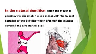 In the natural dentition, when the mouth is
passive, the buccinator is in contact with the buccal
surfaces of the posterior teeth and with the mucosa
covering the alveolar process
 