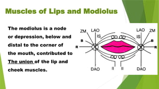 The modiolus is a node
or depression, below and
distal to the corner of
the mouth, contributed to
The union of the lip and
cheek muscles.
B B
R R
Muscles of Lips and Modiolus
 