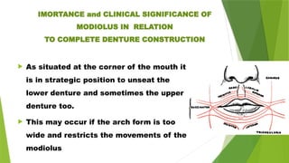 IMORTANCE and CLINICAL SIGNIFICANCE OF
MODIOLUS IN RELATION
TO COMPLETE DENTURE CONSTRUCTION
 As situated at the corner of the mouth it
is in strategic position to unseat the
lower denture and sometimes the upper
denture too.
 This may occur if the arch form is too
wide and restricts the movements of the
modiolus
 