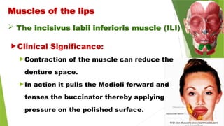  The incisivus labii inferioris muscle (ILI)
Muscles of the lips
 Clinical Significance:
Contraction of the muscle can reduce the
denture space.
In action it pulls the Modioli forward and
tenses the buccinator thereby applying
pressure on the polished surface.
 