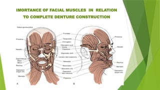 IMORTANCE OF FACIAL MUSCLES IN RELATION
TO COMPLETE DENTURE CONSTRUCTION
 