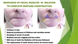  Collapse of Lips
 Reduced prominence of Philtrum and vermilion border
 Drooping of corner of mouth
 Modiolus become sagging and less active
 With loss of teeth the Modiolus will become flattened
 The replacement of teeth should restore its normal shape
IMORTANCE OF FACIAL MUSCLES IN RELATION
TO COMPLETE DENTURE CONSTRUCTION
 