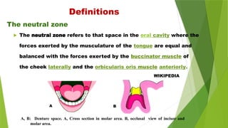 A, B: Denture space. A, Cross section in molar area. B, occlusal view of incisor and
molar area.
The neutral zone
Definitions
 The neutral zone refers to that space in the oral cavity where the
forces exerted by the musculature of the tongue are equal and
balanced with the forces exerted by the buccinator muscle of
the cheek laterally and the orbicularis oris muscle anteriorly.
WIKIPEDIA
A B
 