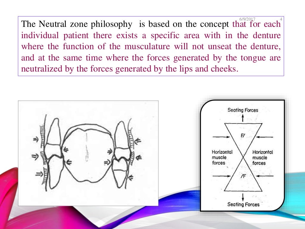 Neutral zone technique Journal club presentation
