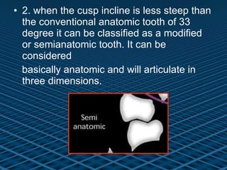 2. when the cusp incline is less steep than the conventional anatomic tooth of 33 degree it can be classified as a modified or semianatomic tooth. It can be considered basically anatomic and will articulate in three dimensions. 