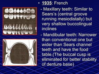 1935 : French  - Maxillary teeth: Similar to Sears’s (central groove running mesiodistally) but very shallow buccolingual inclines  - Mandibular teeth: Narrower than conventional one but wider than Sears channel teeth and have the food table.(The buccal cusp is eliminated for better stability of denture base) 