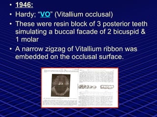 1946: Hardy; “ VO ” (Vitallium occlusal) These were resin block of 3 posterior teeth simulating a buccal facade of 2 bicuspid & 1 molar  A narrow zigzag of Vitallium ribbon was embedded on the occlusal surface. 