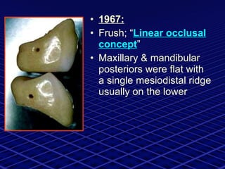 1967: Frush; “ Linear occlusal concept ” Maxillary & mandibular posteriors were flat with a single mesiodistal ridge usually on the lower 