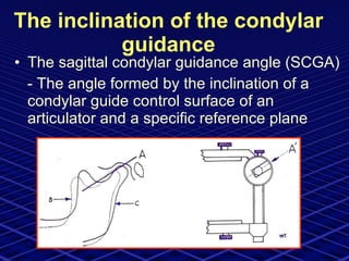 The inclination of the condylar guidance The sagittal condylar guidance angle (SCGA)  - The angle formed by the inclination of a condylar guide control surface of an articulator and a specific reference plane 