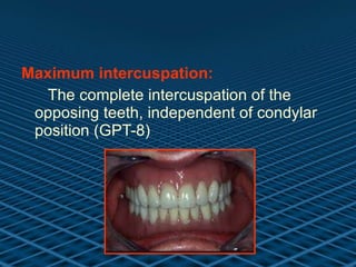 Maximum intercuspation: The complete intercuspation of the opposing teeth, independent of condylar position (GPT-8) 
