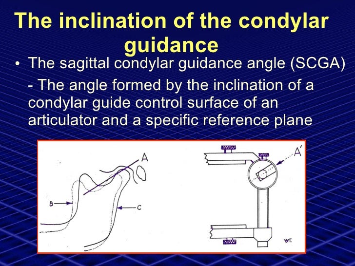 Neutrocentric Concept (prosthodontics)