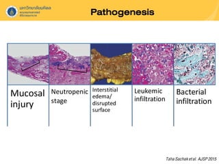 Pathogenesis
Mucosal
injury
Neutropenic
stage
Interstitial
edema/
disrupted
surface
Leukemic
infiltration
Bacterial
infiltration
TahaSachaketal. AJSP2015
 