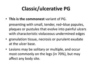 Classic/ulcerative PG
• This is the commonest variant of PG.
presenting with small, tender, red–blue papules,
plaques or pustules that evolve into painful ulcers
with characteristic violaceous undermined edges
• granulation tissue, necrosis or purulent exudate
at the ulcer base.
• Lesions may be solitary or multiple, and occur
most commonly on the legs (in 70%), but may
affect any body site.
 