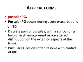 ATYPICAL FORMS
• pustular PG.
• Pustular PG occurs during acute exacerbations
of IBD.
• Discrete painful pustules, with a surrounding
halo of erythema,present as a scattered
distribution on the extensor aspects of the
limbs.
• Pustular PG lesions often resolve with control
of IBD.
 