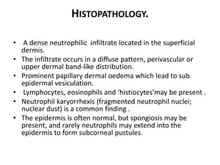 HISTOPATHOLOGY.
• A dense neutrophilic infiltrate located in the superficial
dermis.
• The infiltrate occurs in a diffuse pattern, perivascular or
upper dermal band-like distribution.
• Prominent papillary dermal oedema which lead to sub
epidermal vesiculation.
• Lymphocytes, eosinophils and ‘histiocytes’may be present .
• Neutrophil karyorrhexis (fragmented neutrophil nuclei;
nuclear dust) is a common finding .
• The epidermis is often normal, but spongiosis may be
present, and rarely neutrophils may extend into the
epidermis to form subcorneal pustules.
 