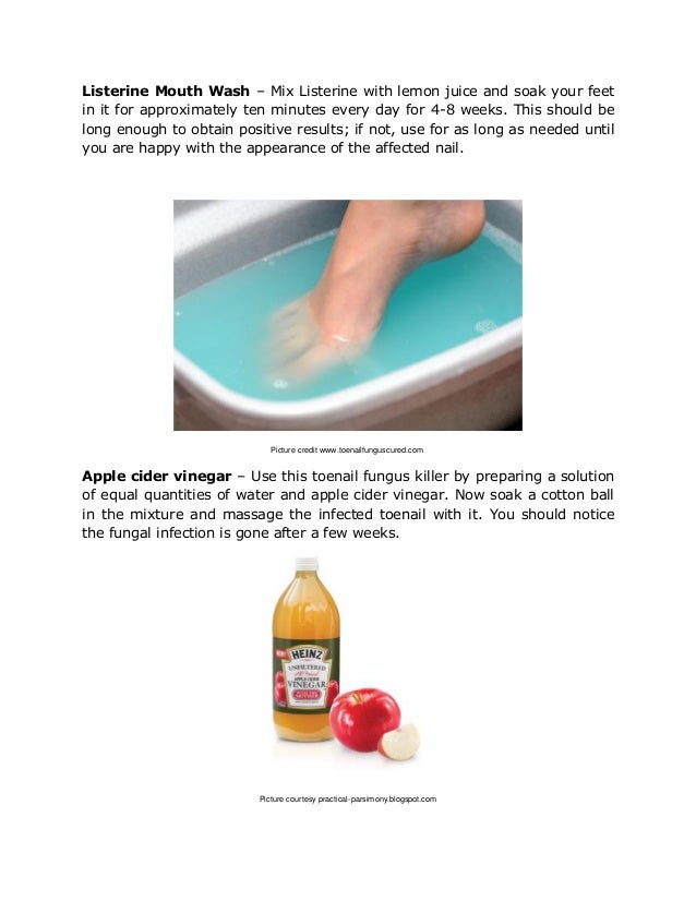 Never before seen toenail fungus remedy