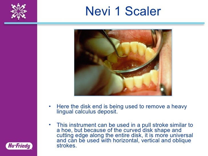Nevi Scalers