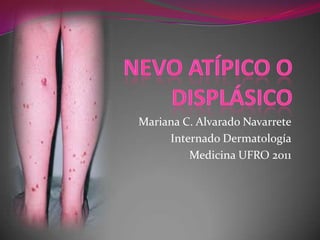 Mariana C. Alvarado Navarrete
     Internado Dermatología
         Medicina UFRO 2011
 