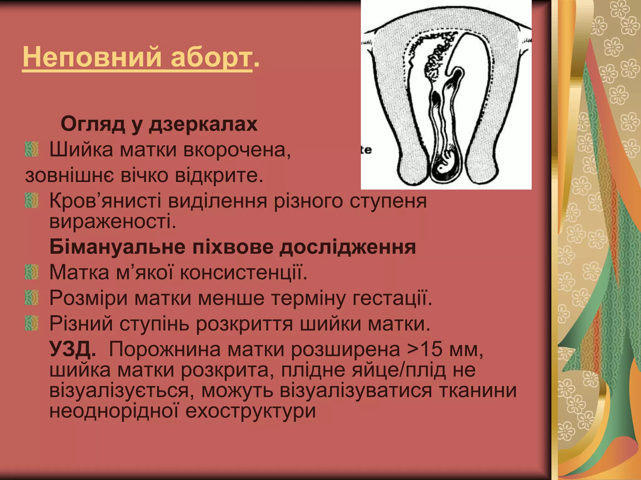 Неповний аборт.
Огляд у дзеркалах
Шийка матки вкорочена,
зовнішнє вічко відкрите.
Кров’янисті виділення різного ступеня
вираженості.
Бімануальне піхвове дослідження
Матка м’якої консистенції.
Розміри матки менше терміну гестації.
Різний ступінь розкриття шийки матки.
УЗД. Порожнина матки розширена >15 мм,
шийка матки розкрита, плідне яйце/плід не
візуалізується, можуть візуалізуватися тканини
неоднорідної ехоструктури
 