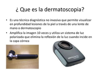 ¿ Que es la dermatoscopia?
• Es una técnica diagnóstica no invasiva que permite visualizar
en profundidad lesiones de la piel a través de una lente de
mano o dermatoscopio
• Amplifica la imagen 10 veces y utiliza un sistema de luz
polarizada que elimina la reflexión de la luz cuando incide en
la capa córnea
 