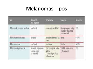 Melanomas Tipos
 