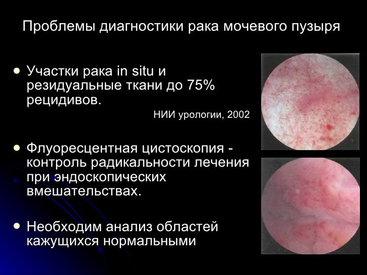 Пленка флуоресцентная форда