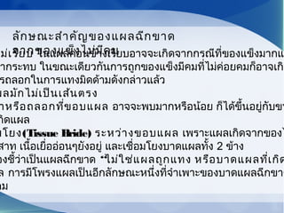 ม่เรียบ ในแผลค่อนข้างเรียบอาจจะเกิดจากกรณีที่ของแข็งมากแล
มากระทบ ในขณะเดียวกันการถูกของแข็งมีคมที่ไม่ค่อยคมก็อาจเกิด
รถลอกในการแทงมิดด้ามดังกล่าวแล้ว
ผลมักไม่เป็นเส้นตรง
าหรือถลอกที่ขอบแผล อาจจะพบมากหรือน้อย ก็ได้ขึ้นอยู่กับขน
กิดแผล
มโยง(Tissue Bride) ระหว่างขอบแผล เพราะแผลเกิดจากของไ
สาท เนื้อเยื่ออ่อนๆยังอยู่ และเชื่อมโยงบาดแผลทั้ง 2 ข้าง
องชี้ว่าเป็นแผลฉีกขาด “ไม่ใช่แผลถูกแทง หรือบาดแผลที่เกิด
ล การมีโพรงแผลเป็นอีกลักษณะหนึ่งที่จำาเพาะของบาดแผลฉีกขาด
คม
ลักษณะสำาคัญของแผลฉีกขาด
จากของแข็งไม่มีคม
 