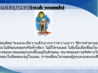 วัตถุมีคม“แผลจะมีความลึกมากกว่าความยาว”มีการทำาลายอว
ยบไม่มีขอบถลอกหรือชำ้าเขียว ไม่มีโพรงแผล ไม่มีเนื้อเยื่อเชื่อมโยง
างของบาดแผลถูกแทงขึ้นอยู่กับลักษณะ ขนาดของอาวุธทิศทางใน
วของใบมีดขณะอยู่ในแผล, การเคลื่อนไหวของผู้ถูกแทงและแรงด
ดแผลถูกแทง(stab wounds)
 