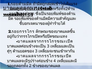 1.รอยด้ามมีด ถ้ามีดถูกสอดเข้าไปเต็มแรง
แผลถูกแทงข้างใดข้างหนึ่งหรือทั้ง2ด้าน
อาจมีรอยถลอก ซึ่งเป็นรอยพิมพ์ของด้าน
มีด รอยพิมพ์ของด้านมีดมีความสำาคัญและ
ชี้บอกเจตนาของผู้ทำาร้ายได้
2.รอยกรรไกร ลักษณะของบาดแผลขึ้น
อยู่กับว่ากรรไกรเปิดหรือปิดขณะแทง
-บาดแผลจากกรรไกรขณะเปิด
บาดแผลค่อนข้างจะเป็น 3 เหลี่ยมและเป็น
คู่ๆ ด้านยอดของ 3 เหลี่ยมจะชนเข้าหากัน
-บาดแผลจากกรรไกรขณะปิด
บาดแผลจะมีรูปร่างค่อนข้าง 4 เหลี่ยมและมี
รอยถลอกทั้ง 2 ข้างของบาดแผล
บาดแผลถูกแทง(stab
wounds)(ต่อ)
 