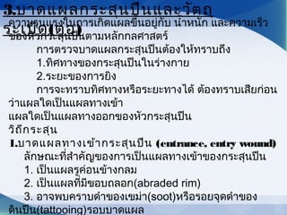 ความรุนแรงในการเกิดแผลขึ้นอยู่กับ นำ้าหนัก และความเร็ว
ของหัวกระสุนปืนตามหลักกลศาสตร์
         การตรวจบาดแผลกระสุนปืนต้องให้ทราบถึง
         1.ทิศทางของกระสุนปืนในร่างกาย
         2.ระยะของการยิง
         การจะทราบทิศทางหรือระยะทางได้ ต้องทราบเสียก่อน
ว่าแผลใดเป็นแผลทางเข้า
แผลใดเป็นแผลทางออกของหัวกระสุนปืน
วิถีกระสุน
1.บาดแผลทางเข้ากระสุนปืน (entrance, entry wound)
     ลักษณะที่สำาคัญของการเป็นแผลทางเข้าของกระสุนปืน
     1. เป็นแผลรูค่อนข้างกลม
     2. เป็นแผลที่มีขอบถลอก(abraded rim)
     3. อาจพบคราบดำาของเขม่า(soot)หรือรอยจุดดำาของ
ดินปืน(tattooing)รอบบาดแผล      
3.บาดแผลกระสุนปืนและวัตถุ
ระเบิด(ต่อ)
 