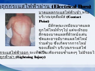 ลถูกกระแสไฟฟ้าผ่าน (Electrical Burn)
บาดแผลกระแสไฟฟ้าเข้า หรือ
บริเวณจุดสัมผัส (Contact
Point)
มีลักษณะเหมือนบาดแผล
ถูกไฟไหม้ทั่วๆไป แต่จะมีรอย
ลึกของบาดแผลที่ผิวหนังเด่น
ชัดและอาจมีบาดแผลไฟไหม้
ร่วมด้วย ซึ่งเกิดจากการไหม้
ของเสื้อผ้า บริเวณกระแสไฟ
ผ่านกระแสไฟฟ้าออก จะเห็นเป็นเพียงรอบชำ้าแดงๆ ไม่มีรอยไห
ถูกฟ้าผ่า (Lightning Injury)
 