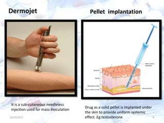 10/20/2012 8
Dermojet Pellet implantation
It is a sub-cutaneous needleless
injection used for mass inoculation
Drug as a solid pellet is implanted under
the skin to provide uniform systemic
effect .Eg:testosterone
