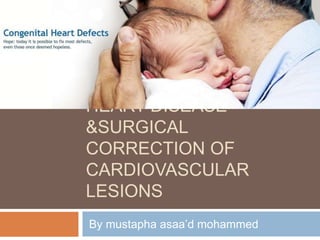 CONGENITAL HEART
DISEASE &RHEUMATIC
HEART DISEASE
&SURGICAL
CORRECTION OF
CARDIOVASCULAR
LESIONS
By mustapha asaa’d mohammed

 