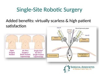 Single-Site Robotic Surgery
Added benefits: virtually scarless & high patient
satisfaction
 