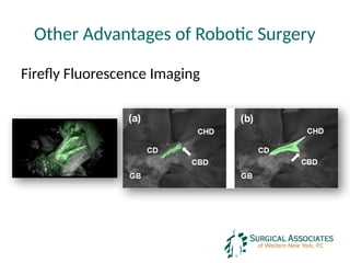 Other Advantages of Robotic Surgery
Firefly Fluorescence Imaging
 