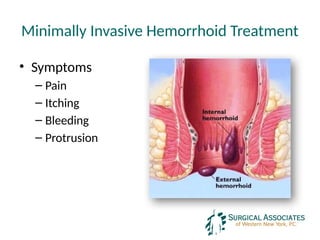 Minimally Invasive Hemorrhoid Treatment
• Symptoms
– Pain
– Itching
– Bleeding
– Protrusion
 