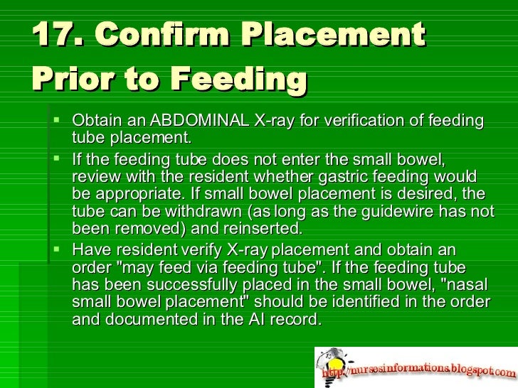 Procedure for inserting an oral/nasal small bowel feeding tube in CCTC