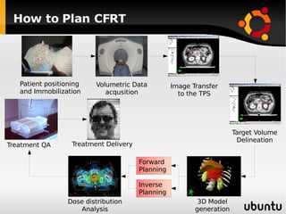 How to Plan CFRT Patient positioning and Immobilization Volumetric Data acqusition Image Transfer to the TPS Target Volume Delineation 3D Model generation Forward Planning Inverse Planning Dose distribution Analysis Treatment QA Treatment Delivery 