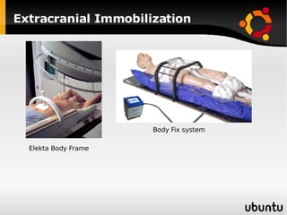 Extracranial Immobilization Elekta Body Frame Body Fix system 