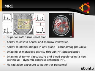 MRI Superior soft tissue resolution Ability to assess neural and marrow infiltration Ability to obtain images in any plane - coronal/saggital/axial Imaging of metabolic activity through MR Spectroscopy Imaging of tumor vasculature and blood supply using a new technique – dynamic contrast enhanced MRI No radiation exposure to patient or personnel 