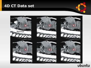 4D CT Data set Normal 