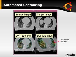 Automated Contouring Movement vectors 