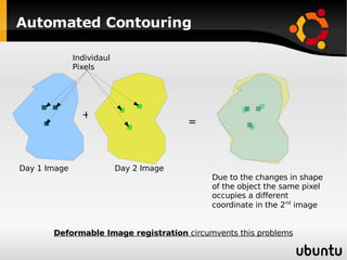 Automated Contouring Day 1 Image Day 2 Image Individaul Pixels Due to the changes in shape of the object the same pixel occupies a different coordinate in the 2 nd  image + = Deformable Image registration  circumvents this problems 