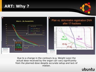 ART: Why ? Due to a change in the contours (e.g. Weight Loss) the actual dose received by the organ can vary significantly from the planned dose despite accurate setup and lack of motion. 