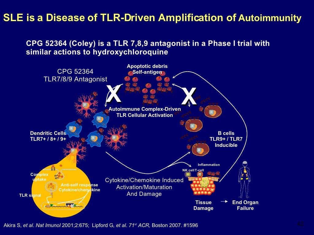 New Treatments For Lupus By Daniel J Wallace Md