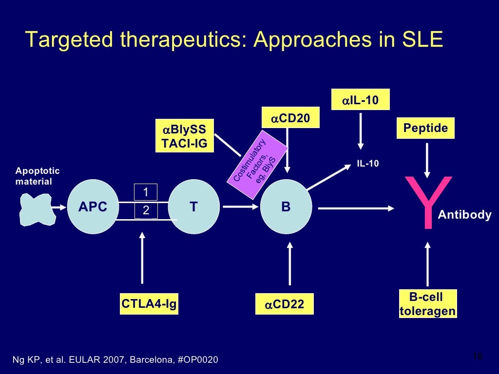 New Treatments for Lupus by Daniel J. Wallace, MD